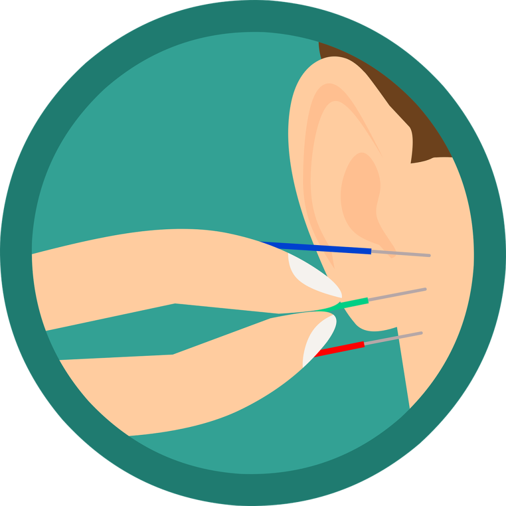Akupunktura ucha to bardzo skuteczny zabieg.