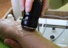 Indiba active to skuteczna terapia